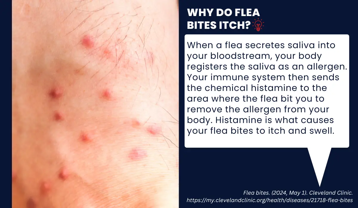 Why do flea bites itch